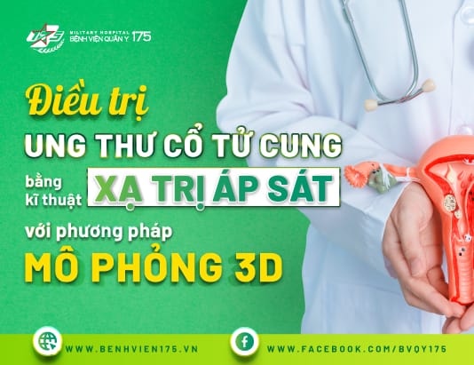Điều trị Ung thư cổ tử cung bằng kĩ thuật xạ trị áp sát với phương pháp mô phỏng 3D