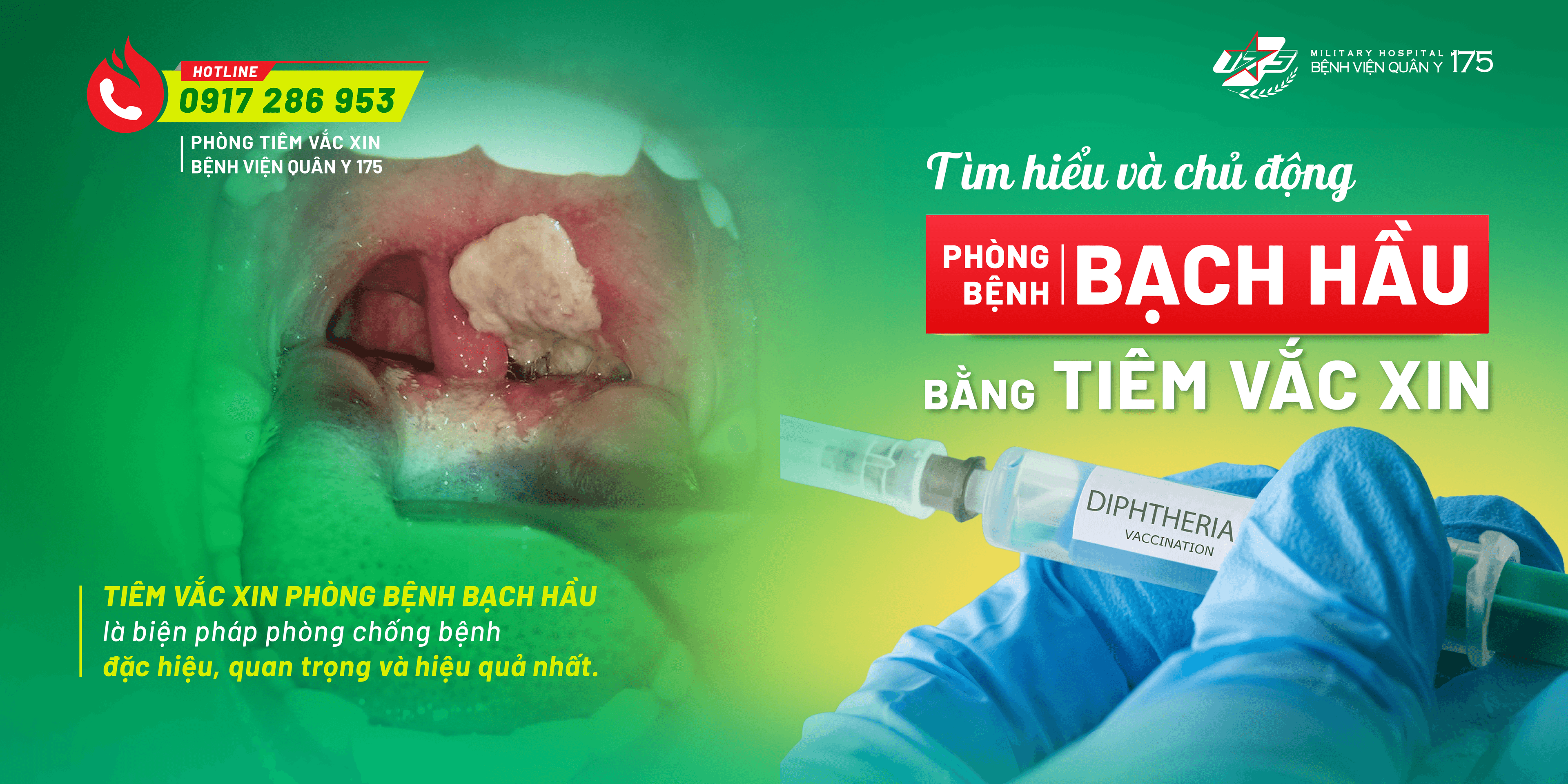 Tìm hiểu và chủ động phòng bệnh bạch hầu bằng tiêm vắc xin