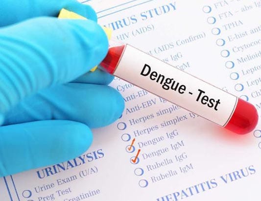 Sốt xuất huyết bao lâu thì khỏi? Những sai lầm khiến bệnh chuyển nặng