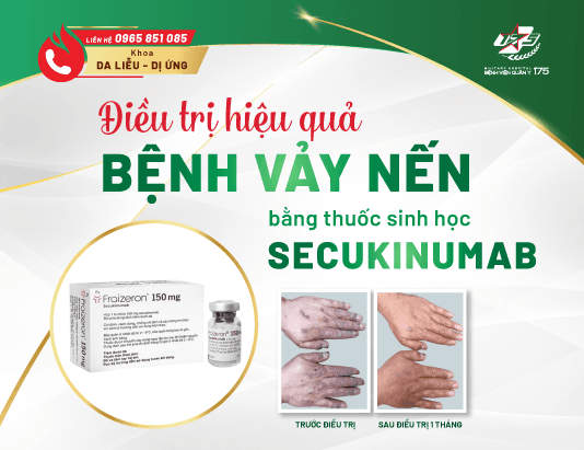 Điều trị hiệu quả bệnh vảy nến bằng thuốc sinh học Secukinumab