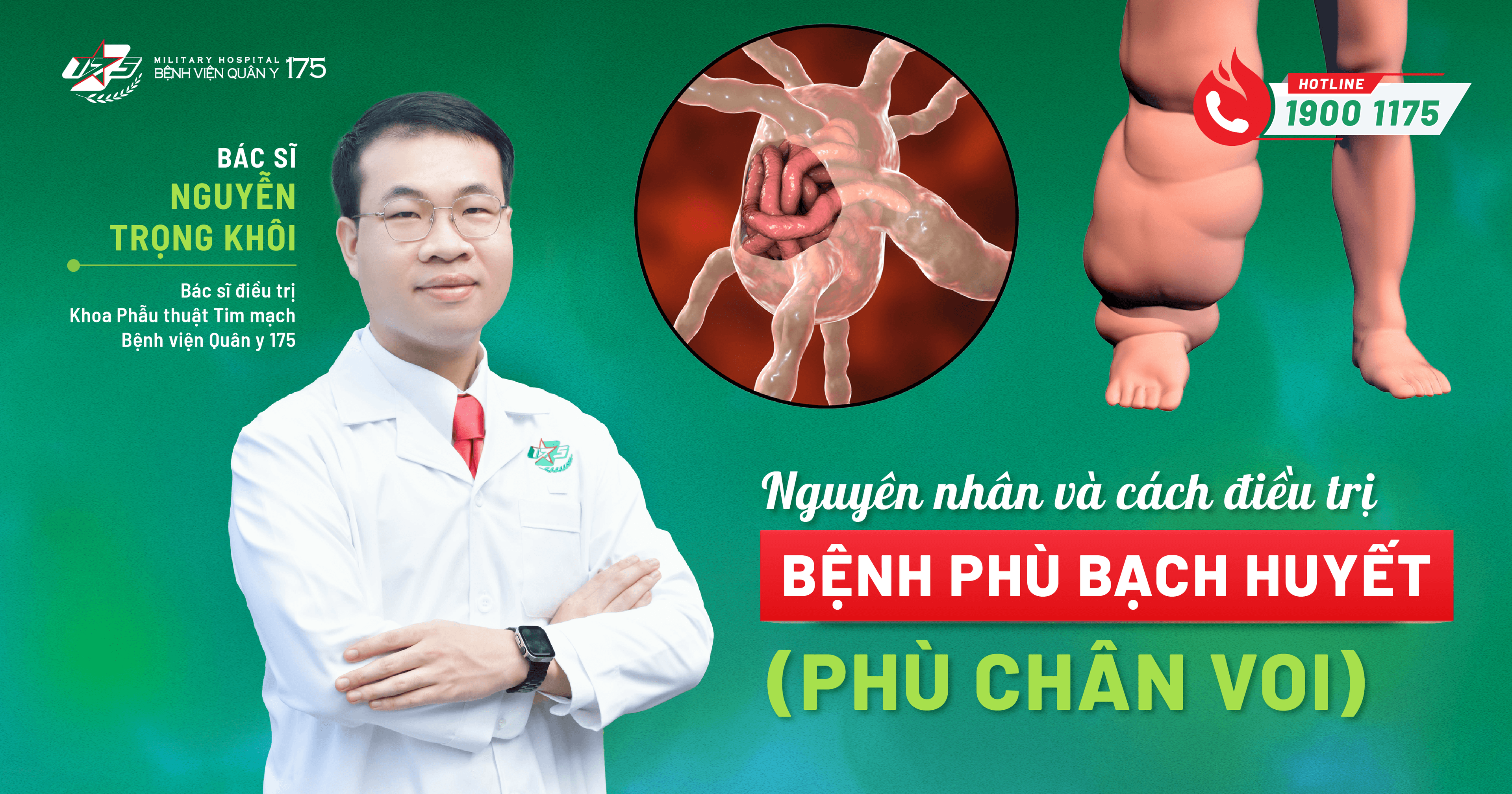 Nguyên nhân và cách điều trị bệnh phù bạch huyết (phù chân voi)