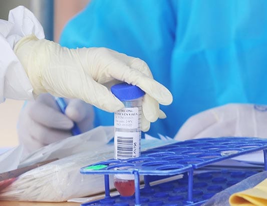 Việt Nam đã chủ động ứng phó với biến chủng Omicron như thế nào?