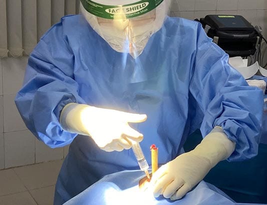 Cứu sống bệnh nhân bị cây tre đâm hốc mắt xuyên sàn sọ phù dập não