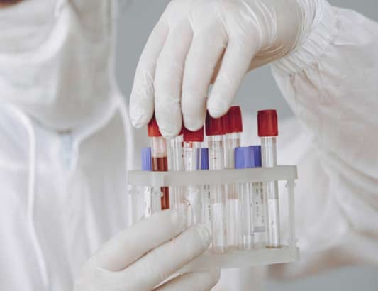 Đăng ký Xét nghiệm chẩn đoán Covid-19 và cấp Giấy chứng nhận xét nghiệm virus SARS-CoV-2 (PCR) cho người nhập cảnh vào Nhật Bản/ Registration: SARS-CoV-2 Test For Immigration to Japan from Vietnam/ 日本入国者向け新型コロナウイルス感染症のPCR検査及び証明書 交付)