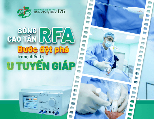 Đốt sóng cao tần RFA  - Bước đột phá trong điều trị bướu tuyến giáp