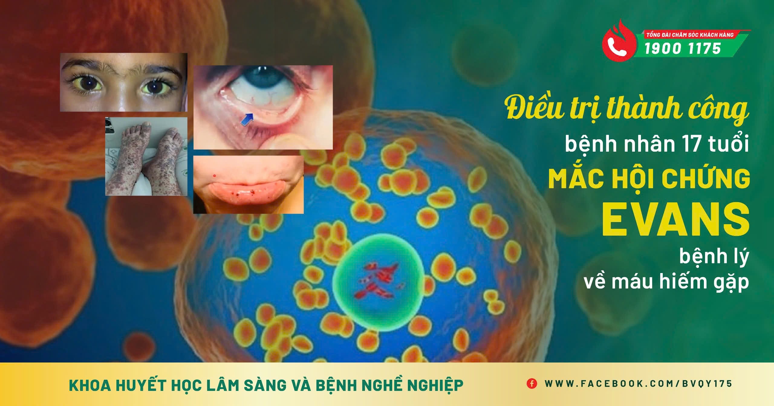 Điều trị thành công bệnh nhân 17 tuổi mắc Hội chứng Evans – Bệnh lý về máu hiếm gặp