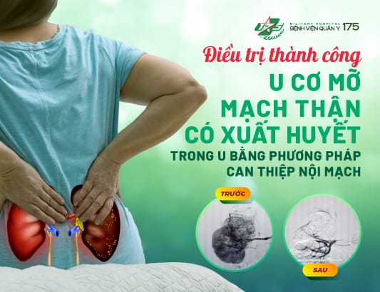 Điều trị thành công u cơ mỡ mạch thận có xuất huyết trong u bằng phương pháp can thiệp nội mạch