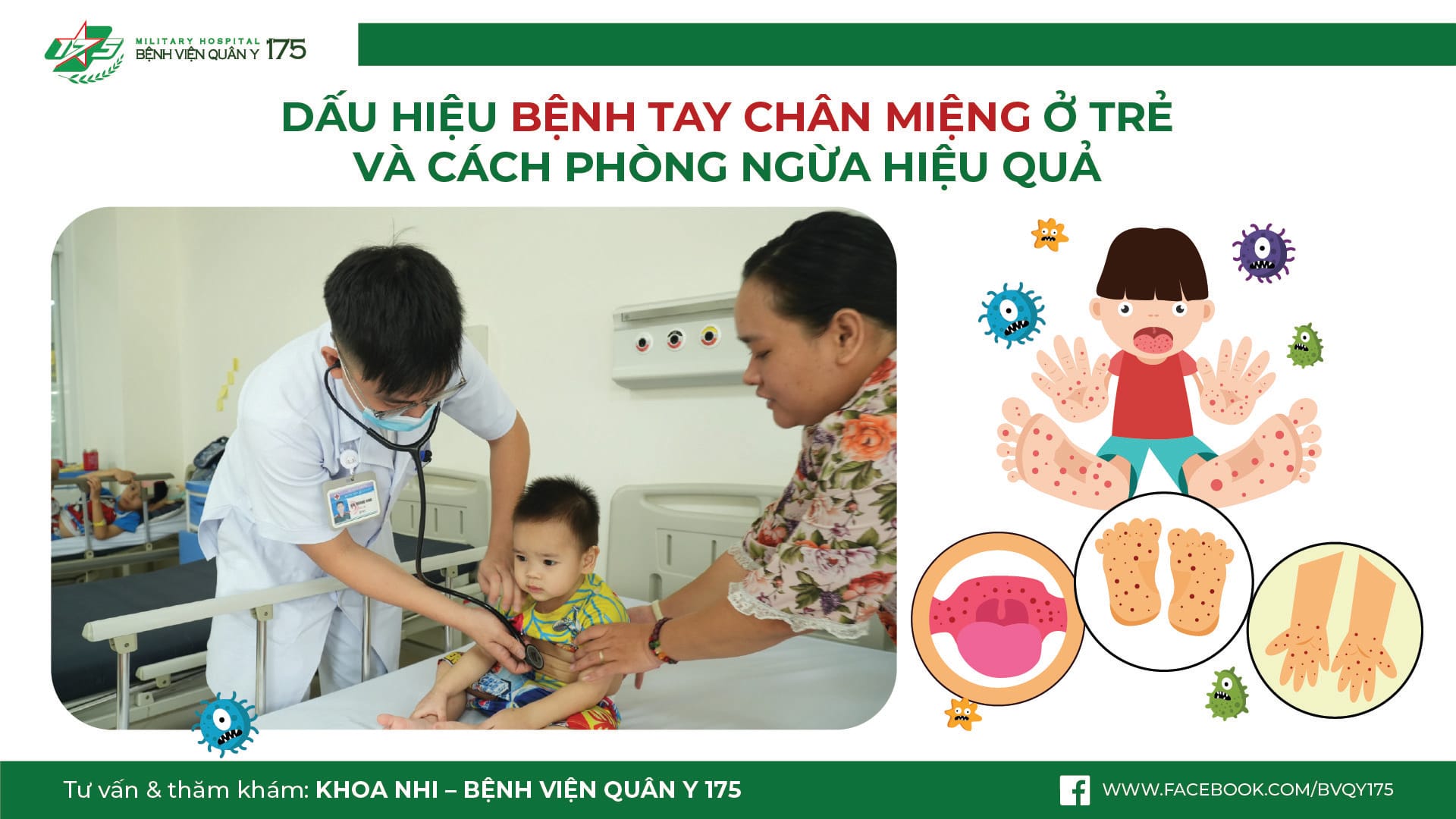 Dấu hiệu bệnh tay chân miệng ở trẻ em và cách phòng ngừa hiệu quả