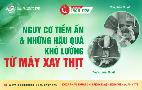 Nguy cơ tiềm ẩn và những hậu quả khó lường từ máy xay thịt
