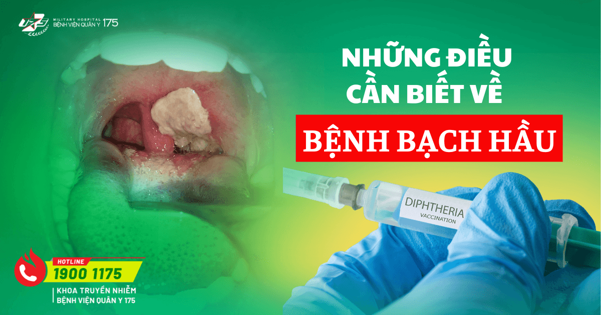 Những điều cần biết về bệnh bạch hầu