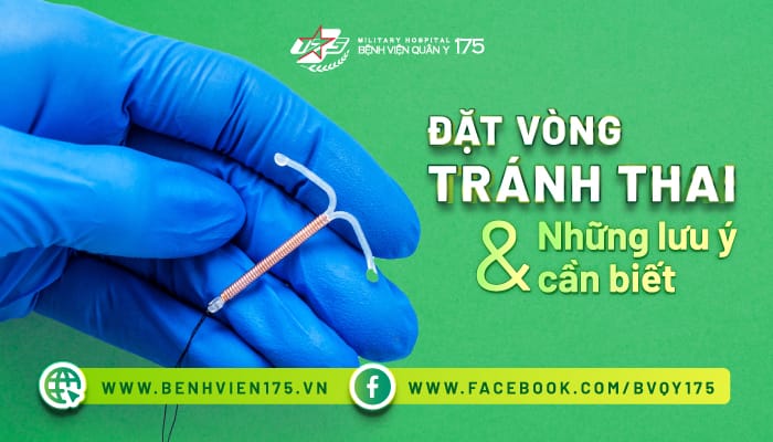 Đặt vòng tránh thai và những lưu ý cần biết